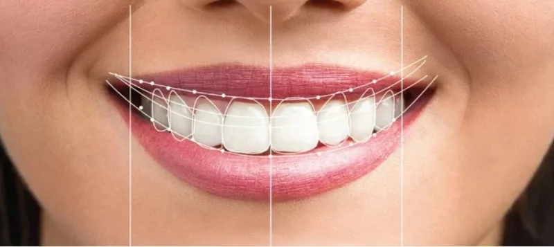 ابتسامة هوليود لطب الأسنان في إيران